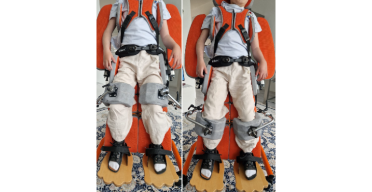 Help onze 10-jarige dochter met scoliose/spierziekte veilig vervoerd worden