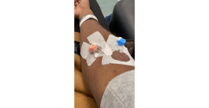 Hulp gevraagd tegen Colitis Ulcerosa en de Ziekte van Crohn.